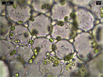 Cytobacts: Abundant and Diverse Vertically Seed-Transmitted Cultivation-Recalcitrant Intracellular Bacteria Ubiquitous to Vascular Plants